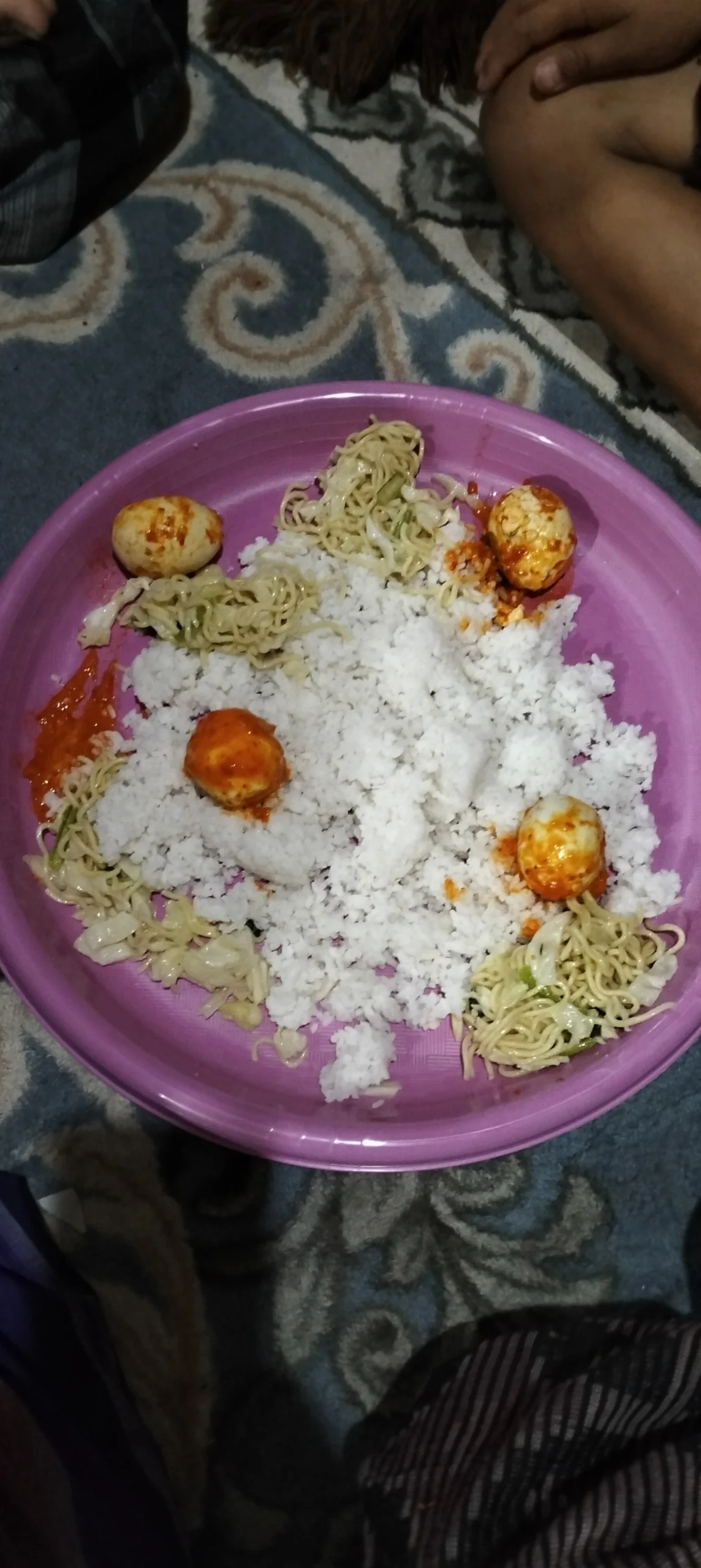 Anak-Anak Dhuafa Kekurangan Gizi