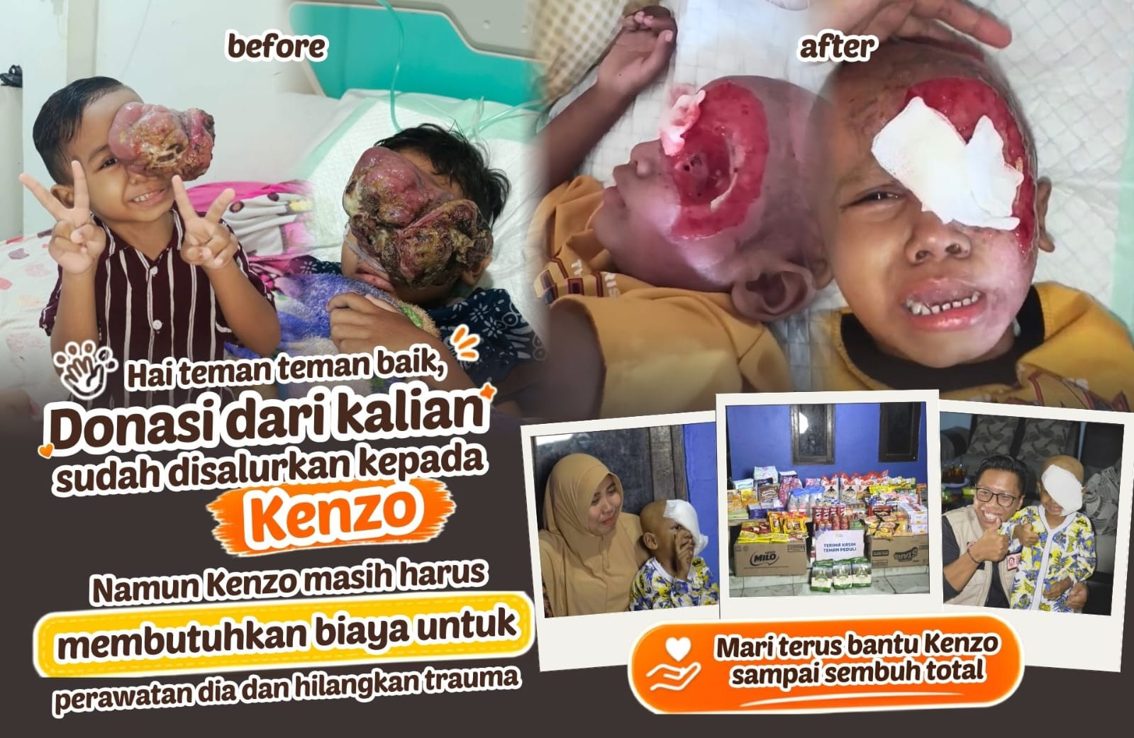 Cahaya Peduli
